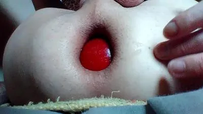 Vue densemble du prolapsus anal vidéo porno